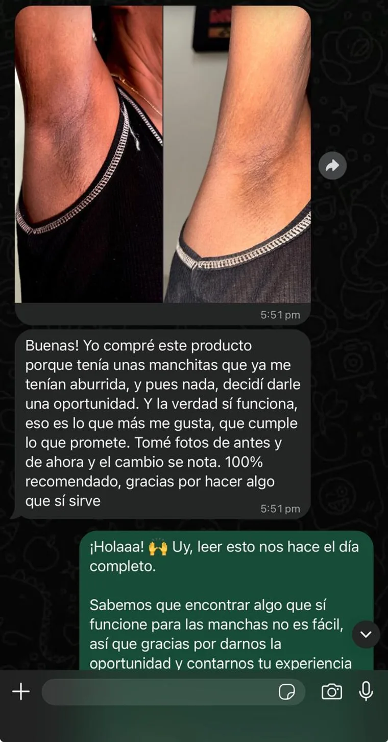 Testimonio real — Teresa